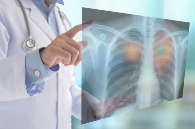 Россиянам назвали главный фактор развития ХОБЛ