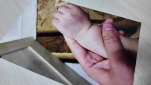 Синяки и перелом: родители заявили о жестоком обращении с ребенком в детсаду Петропавловска (видео)